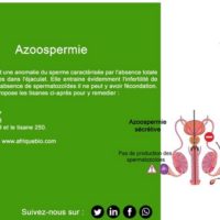 Azoospermia Natural Treatment for Obstructive Azoospermia