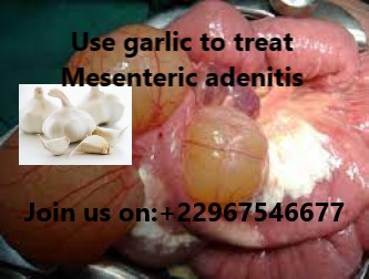 Mesenteric adenitis natural treatment