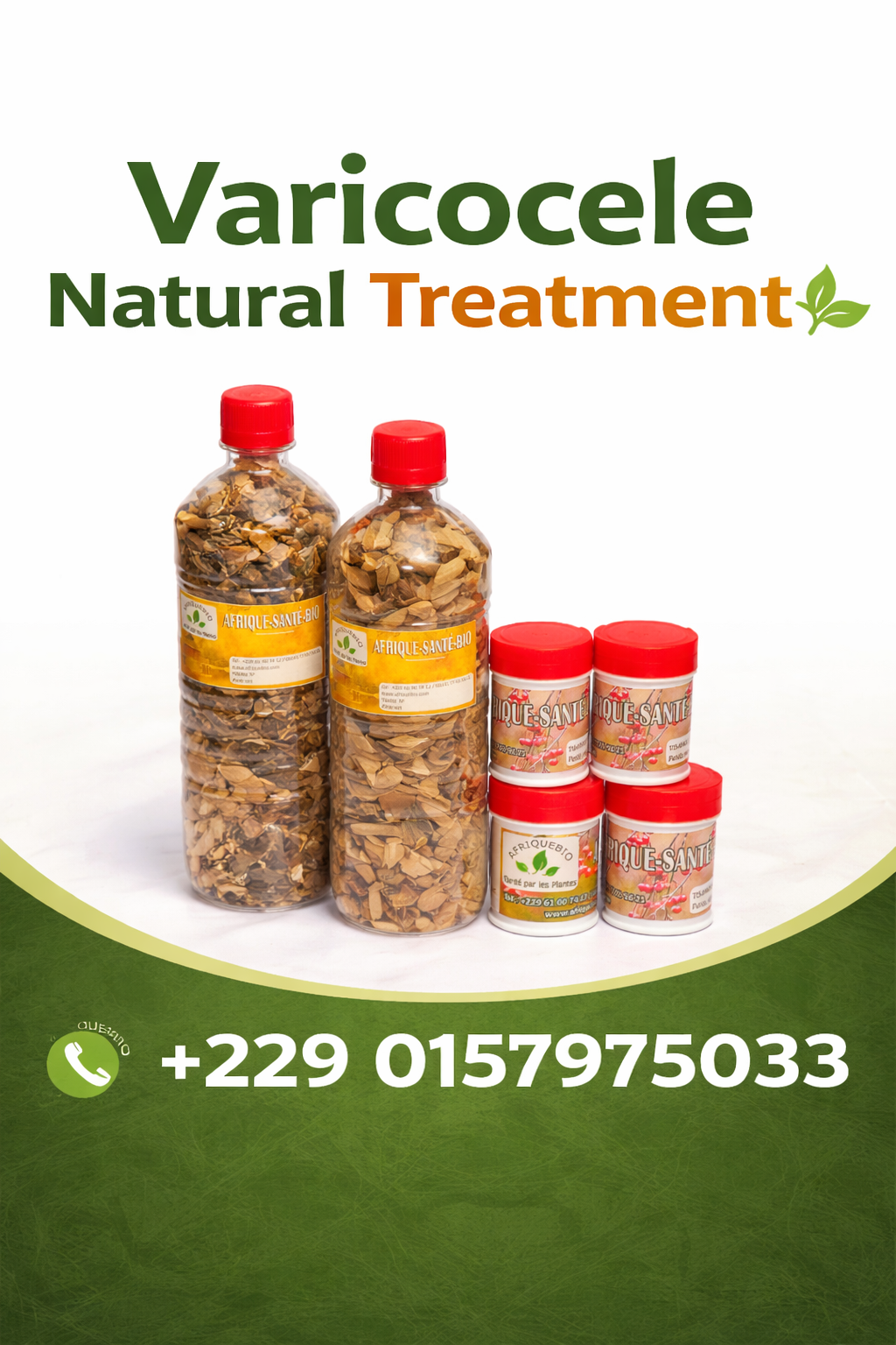 Varicocele Natural Remedies