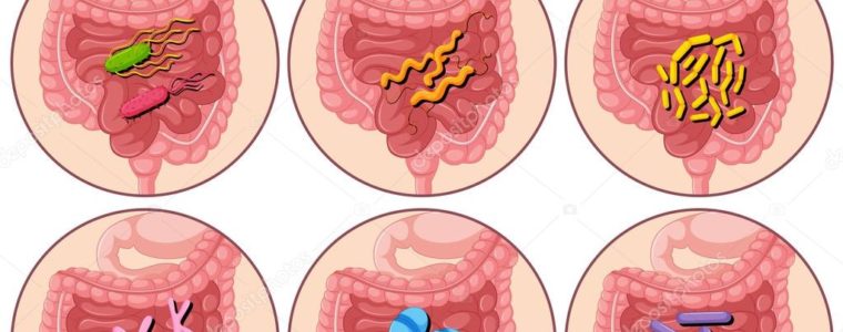 Gastroenteritis: Symtoms, causes and courses
