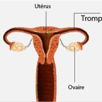 Cyst and fibroid treatment