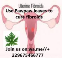Shrink fibroids with pawpaw