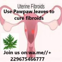 Natural cures Fibroids Naturally