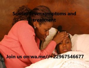 Scarlet fever:symptoms and treatment