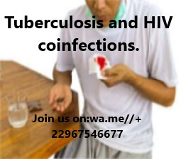 Tuberculosis and HIV coinfections.