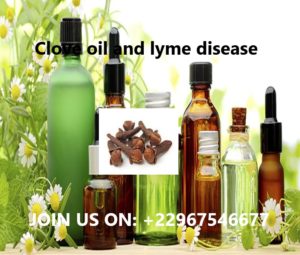 Clove oil and lyme disease