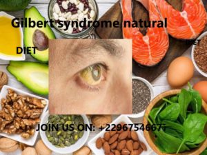 Gilbert syndrome natural diet