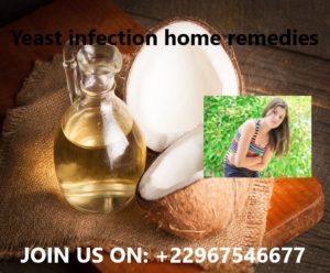 Yeast infection home remedies