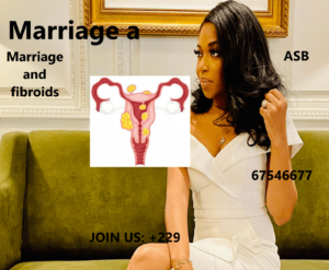 Marriage and fibroids