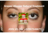 Graves' Disease Natural Treatment