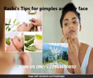 Rachi's Tips for pimples and oily face