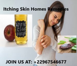 Itching Skin Homes Remedies