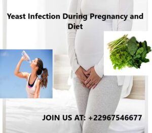 Yeast Infection During Pregnancy and Diet