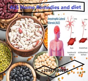 ALS Home Remedies and diet