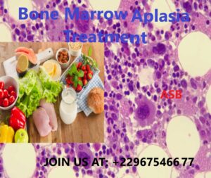 Bone Marrow Aplasia Treatment