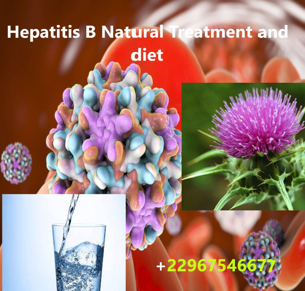 hepatitis-b-natural-treatment-and-diet