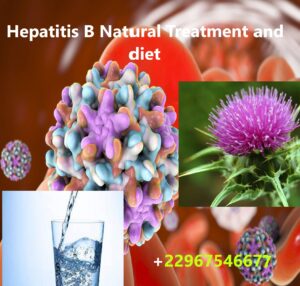 Hepatitis B Natural Treatment and diet