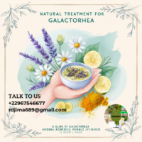 Galactorrhea Natural Treatment