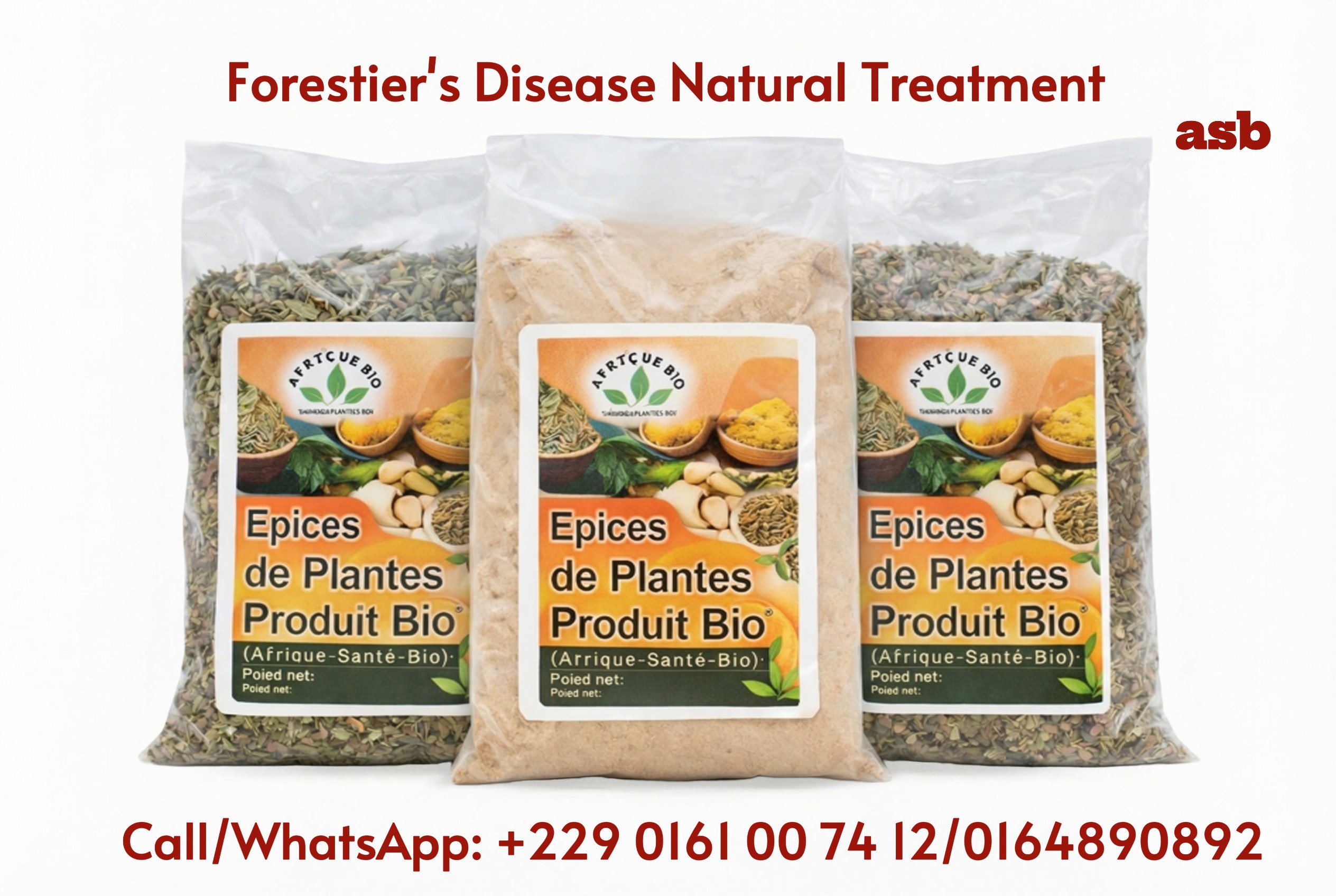 Forestier’s Disease Natural Support