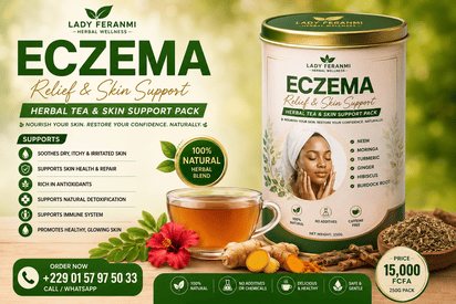 Natural Eczema Relief